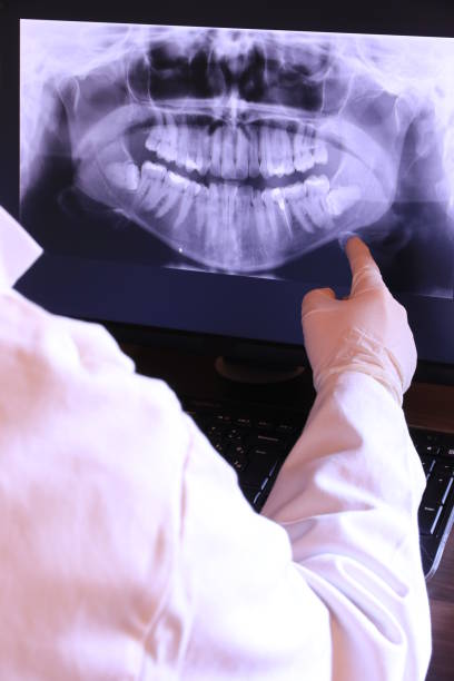 Best Emergency Denture Repair in USA